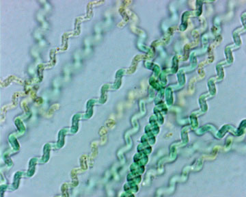 microscopic-spirulina